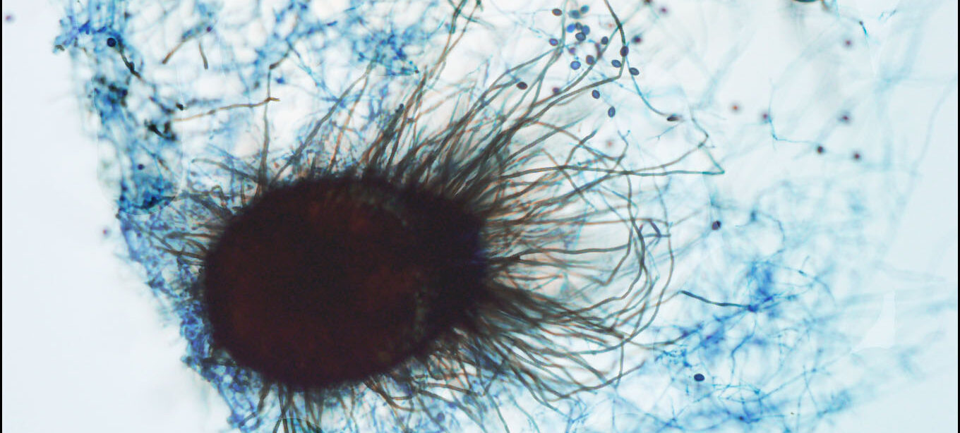 CHAETOMIUM SPP. – “CHIẾN BINH SINH HỌC” VẠN NĂNG